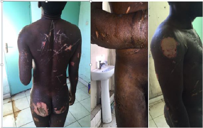 Observatoire Congolais des Droits de l’Homme: La torture interdite et pratiquée à grande échelle…
