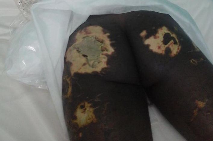 Images: Jugal MAYANGUI torturé par les hommes de Sassou Nguesso
