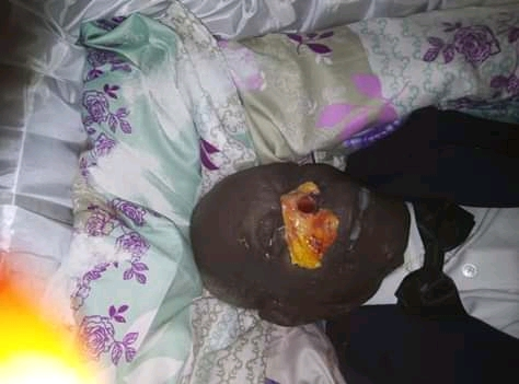 Fait insolite à la morgue municipale de Dolisie : Qui a mutilé le cadavre de M. Casimir Mboukou ?